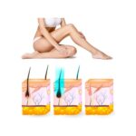 Yui IPLV16 Pro Otomatik ve Manuel Atım Buz Lazer Epilasyon Cihazı - Görsel 3