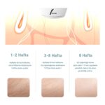 Veryfit AM001 - 900.000 Atım Otomatik / Manuel 8 Kademeli Tüm Vücut Kullanıma Uygun Ipl - 
Epilasyon Cihazı - Görsel 5