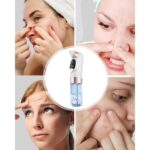 Cansa Elektrikli Siyah Nokta Cihazı - Görsel 3